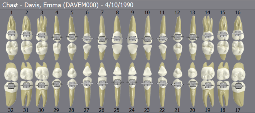 DentiMax Chart Screen